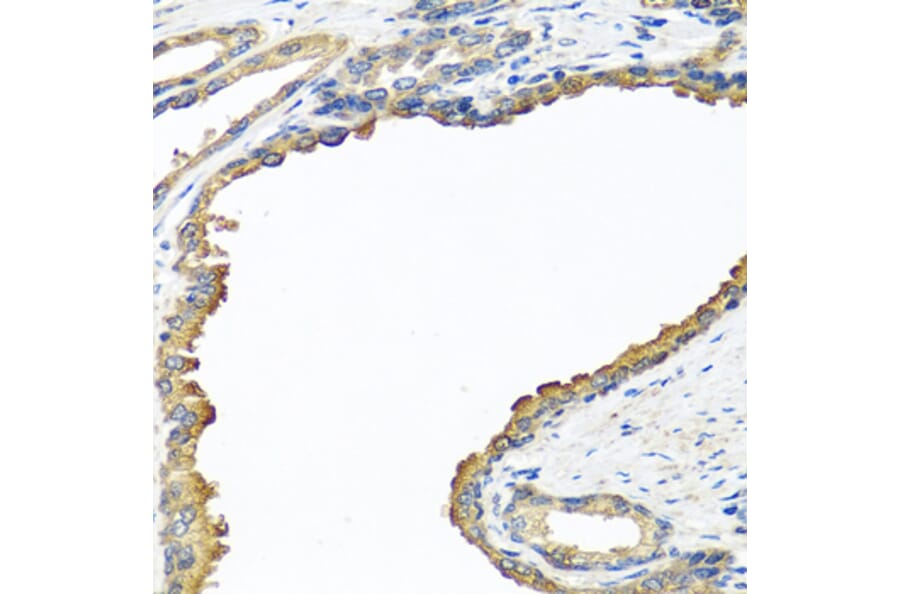 Immunohistochemistry - Anti-Nyctalopin Antibody (A12175) - Antibodies.com