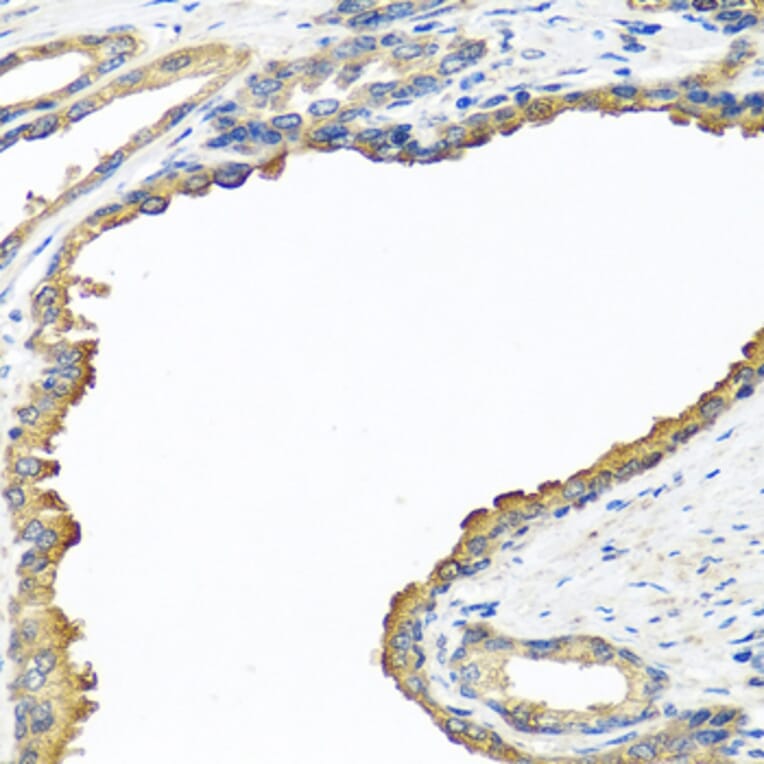 Immunohistochemistry - Anti-Nyctalopin Antibody (A12175) - Antibodies.com
