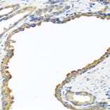 Immunohistochemistry - Anti-Nyctalopin Antibody (A12175) - Antibodies.com