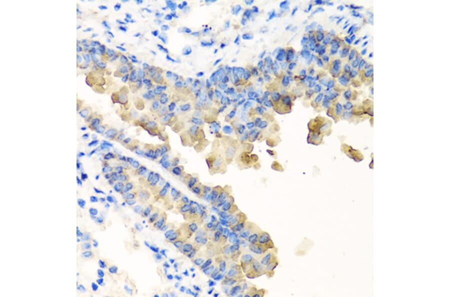 Immunohistochemistry - Anti-Nyctalopin Antibody (A12175) - Antibodies.com