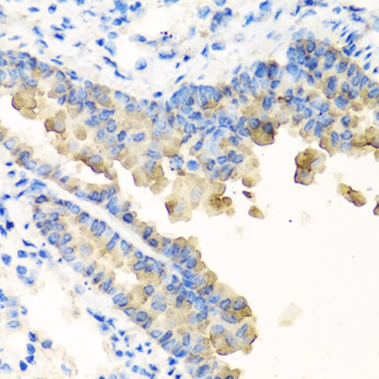 Immunohistochemistry - Anti-Nyctalopin Antibody (A12175) - Antibodies.com