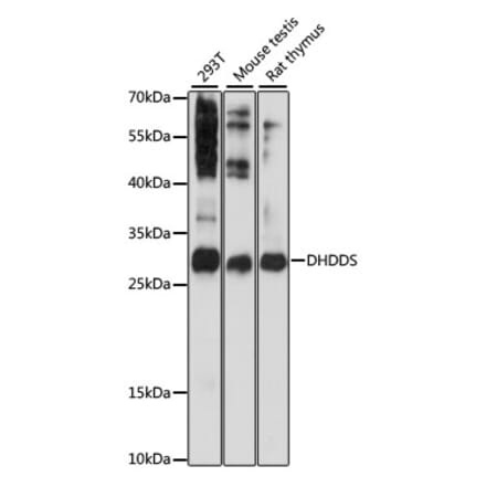 Western Blot - Anti-DHDDS Antibody (A12176) - Antibodies.com