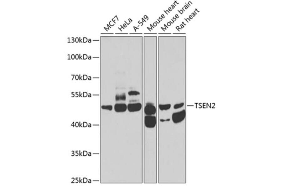 Western Blot - Anti-TSEN2 Antibody (A12177) - Antibodies.com