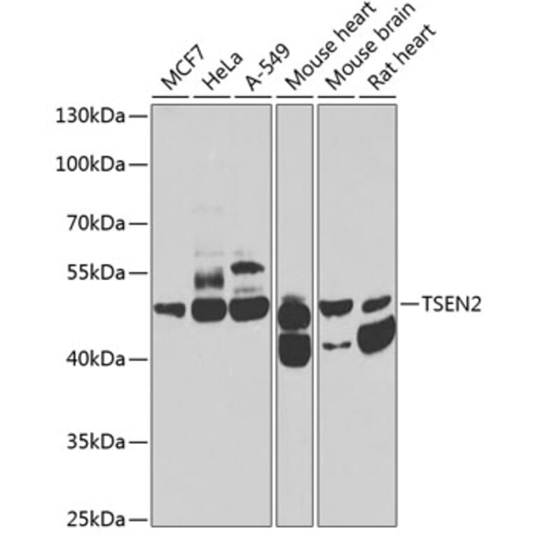 Western Blot - Anti-TSEN2 Antibody (A12177) - Antibodies.com