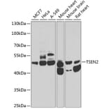 Western Blot - Anti-TSEN2 Antibody (A12177) - Antibodies.com