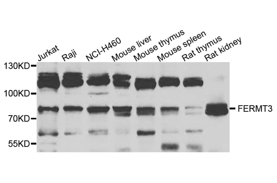 Western Blot - Anti-FERMT3 Antibody (A7839) - Antibodies.com