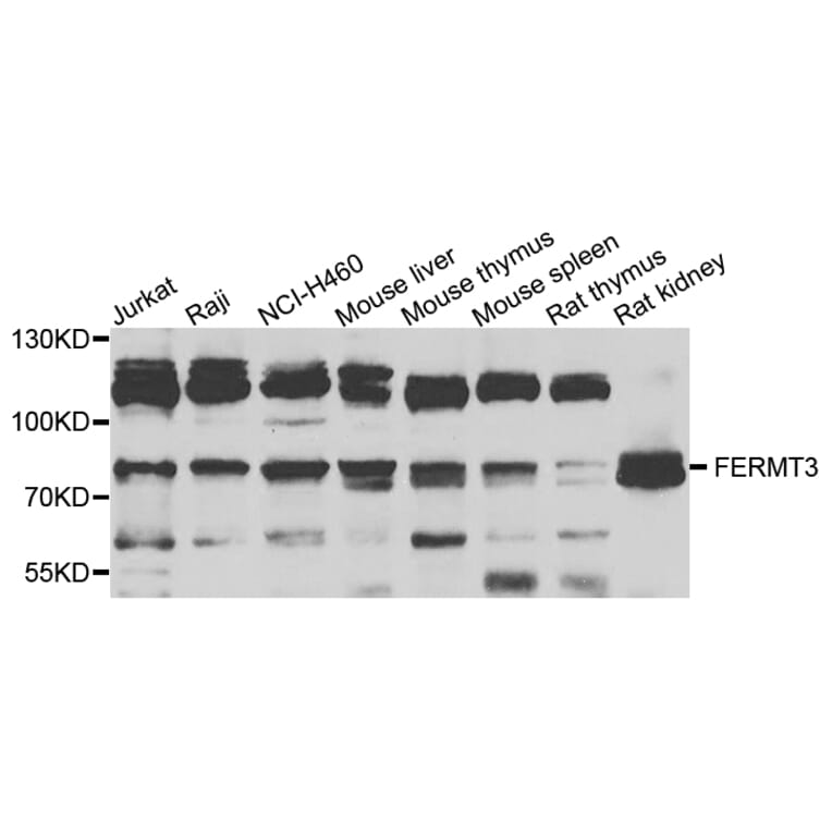 Western Blot - Anti-FERMT3 Antibody (A7839) - Antibodies.com
