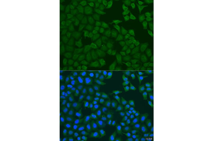 Immunofluorescence - Anti-FERMT3 Antibody (A7839) - Antibodies.com