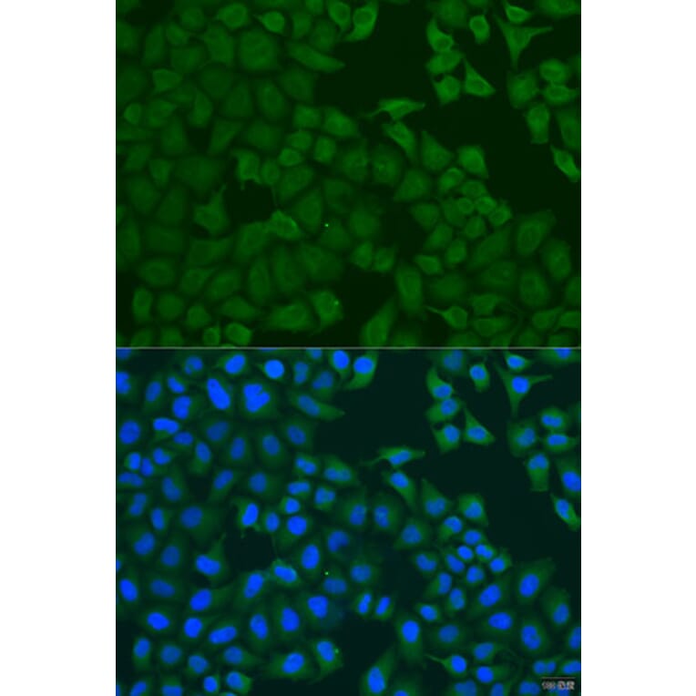 Immunofluorescence - Anti-FERMT3 Antibody (A7839) - Antibodies.com