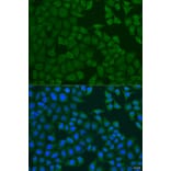 Immunofluorescence - Anti-FERMT3 Antibody (A7839) - Antibodies.com