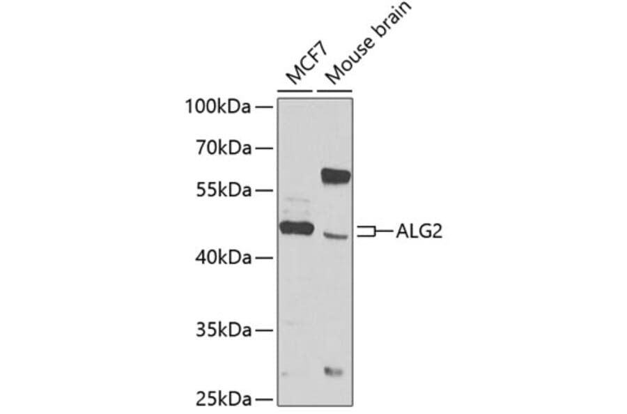Western Blot - Anti-ALG2 Antibody (A12179) - Antibodies.com