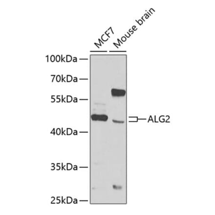 Western Blot - Anti-ALG2 Antibody (A12179) - Antibodies.com