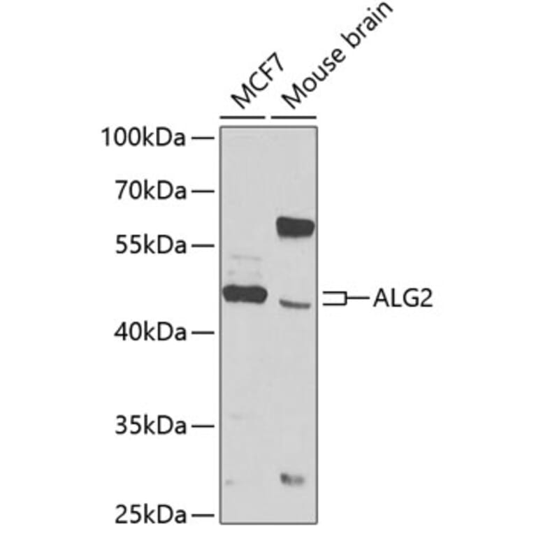 Western Blot - Anti-ALG2 Antibody (A12179) - Antibodies.com