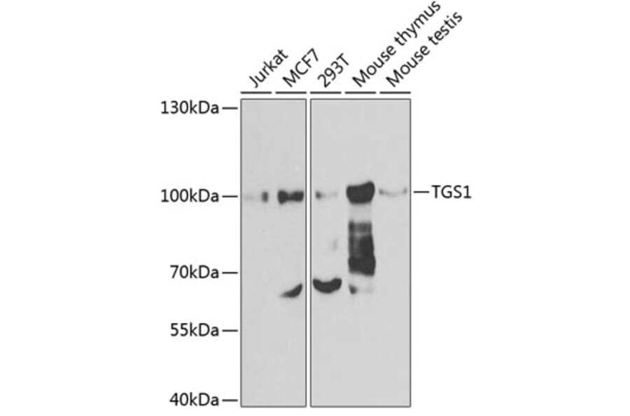 Western Blot - Anti-PIMT Antibody (A12180) - Antibodies.com