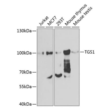 Western Blot - Anti-PIMT Antibody (A12180) - Antibodies.com