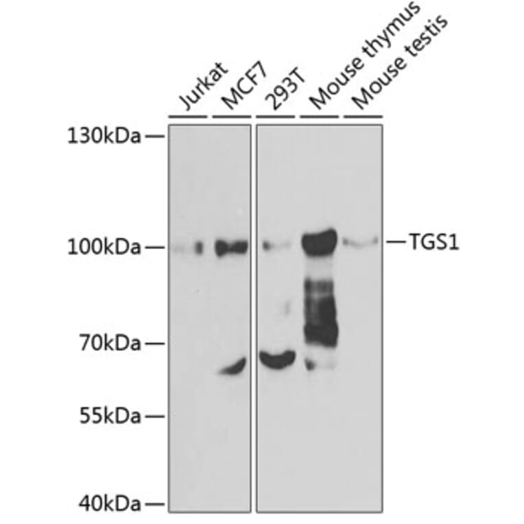 Western Blot - Anti-PIMT Antibody (A12180) - Antibodies.com