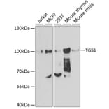 Western Blot - Anti-PIMT Antibody (A12180) - Antibodies.com