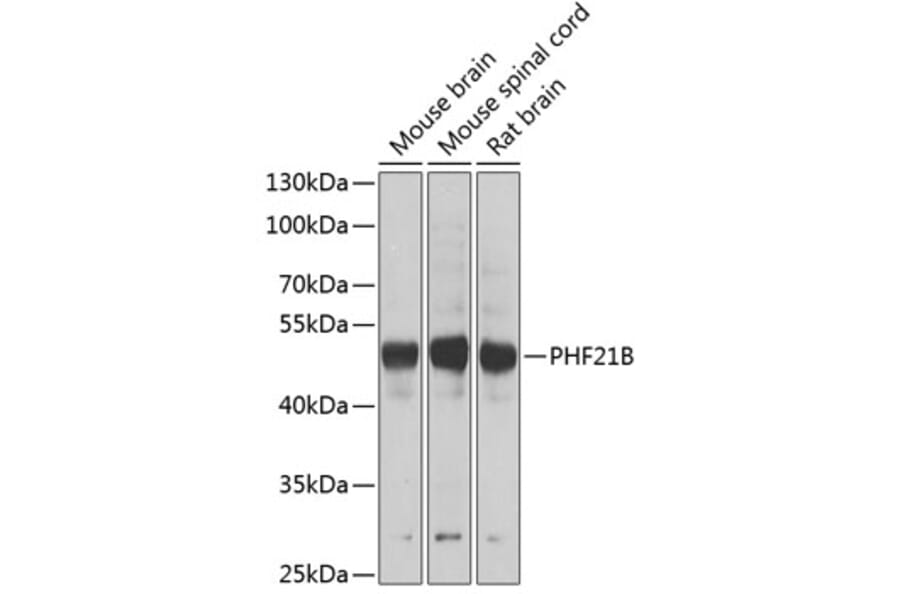 Western Blot - Anti-PHF21B Antibody (A12181) - Antibodies.com
