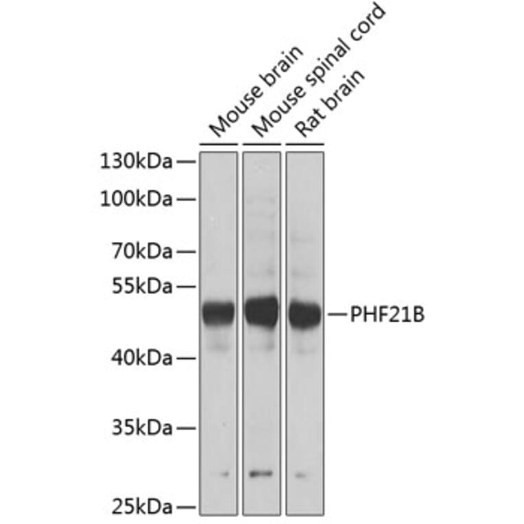 Western Blot - Anti-PHF21B Antibody (A12181) - Antibodies.com