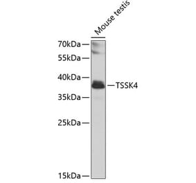 Western Blot - Anti-TSSK4 Antibody (A12182) - Antibodies.com