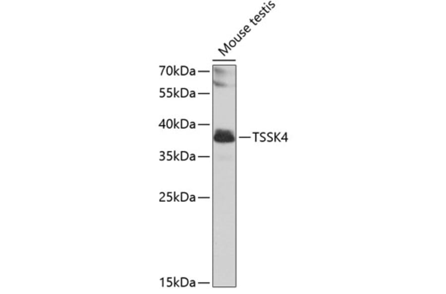 Western Blot - Anti-TSSK4 Antibody (A12182) - Antibodies.com