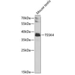 Western Blot - Anti-TSSK4 Antibody (A12182) - Antibodies.com