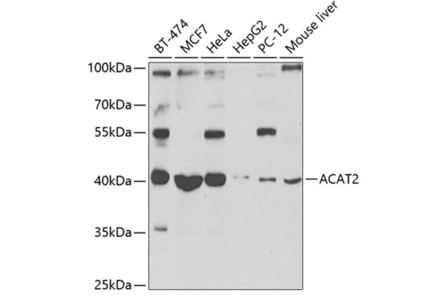 Western Blot - Anti-ACAT2/Acetyl-CoA acetyltransferase Antibody (A12183) - Antibodies.com