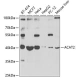 Western Blot - Anti-ACAT2/Acetyl-CoA acetyltransferase Antibody (A12183) - Antibodies.com