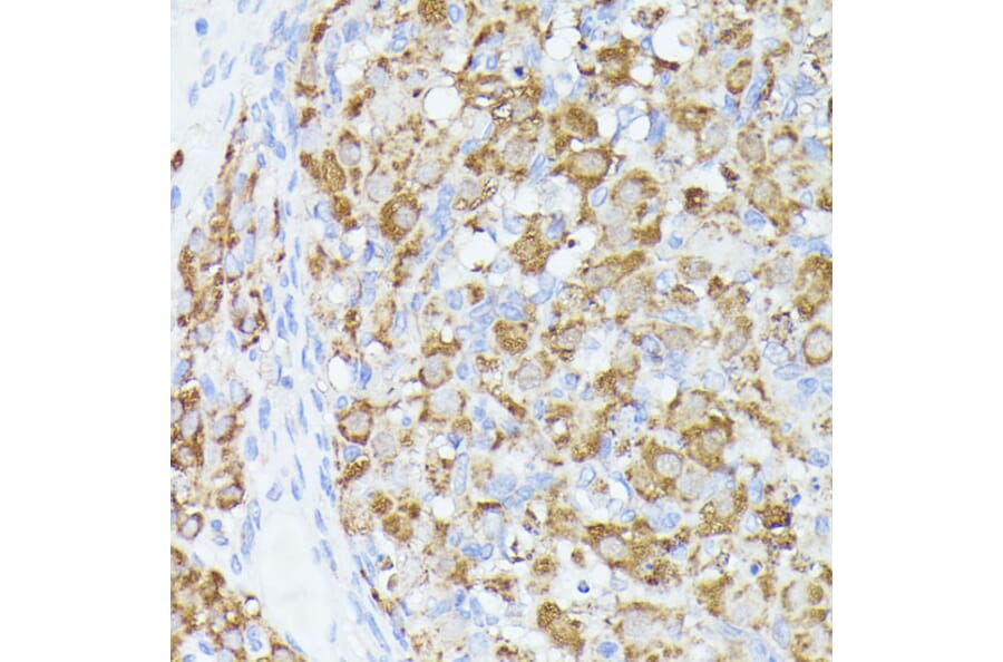 Immunohistochemistry - Anti-ACAT2/Acetyl-CoA acetyltransferase Antibody (A12183) - Antibodies.com