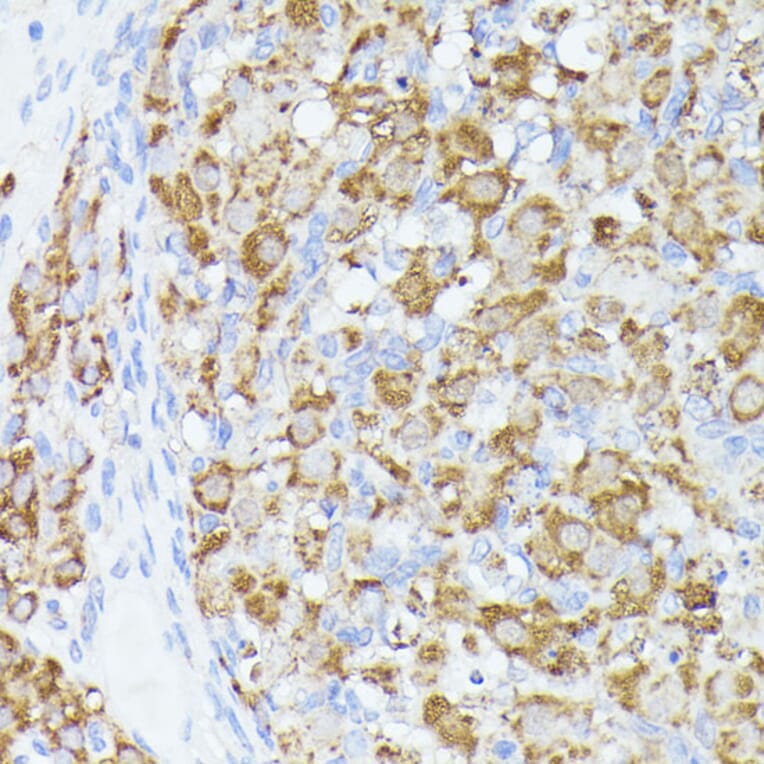 Immunohistochemistry - Anti-ACAT2/Acetyl-CoA acetyltransferase Antibody (A12183) - Antibodies.com