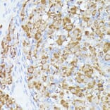 Immunohistochemistry - Anti-ACAT2/Acetyl-CoA acetyltransferase Antibody (A12183) - Antibodies.com