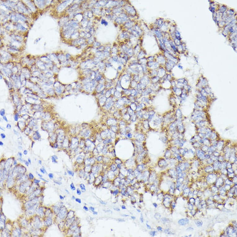 Immunohistochemistry - Anti-ACAT2/Acetyl-CoA acetyltransferase Antibody (A12183) - Antibodies.com