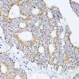 Immunohistochemistry - Anti-ACAT2/Acetyl-CoA acetyltransferase Antibody (A12183) - Antibodies.com