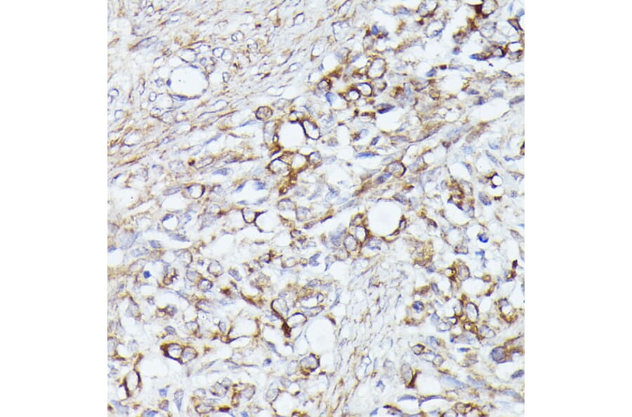 Immunohistochemistry - Anti-ACAT2/Acetyl-CoA acetyltransferase Antibody (A12183) - Antibodies.com