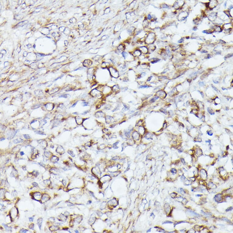 Immunohistochemistry - Anti-ACAT2/Acetyl-CoA acetyltransferase Antibody (A12183) - Antibodies.com