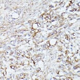 Immunohistochemistry - Anti-ACAT2/Acetyl-CoA acetyltransferase Antibody (A12183) - Antibodies.com
