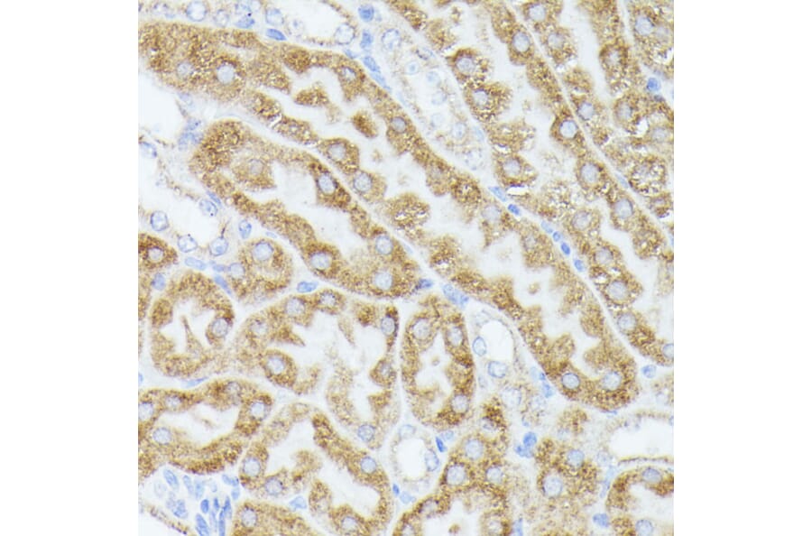 Immunohistochemistry - Anti-ACAT2/Acetyl-CoA acetyltransferase Antibody (A12183) - Antibodies.com