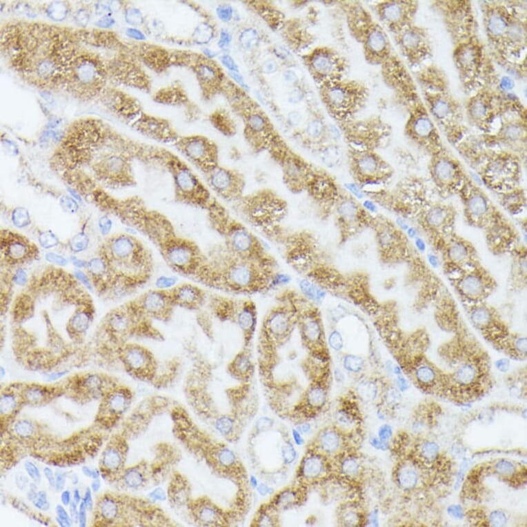 Immunohistochemistry - Anti-ACAT2/Acetyl-CoA acetyltransferase Antibody (A12183) - Antibodies.com
