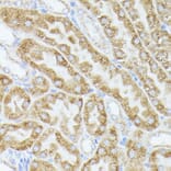 Immunohistochemistry - Anti-ACAT2/Acetyl-CoA acetyltransferase Antibody (A12183) - Antibodies.com