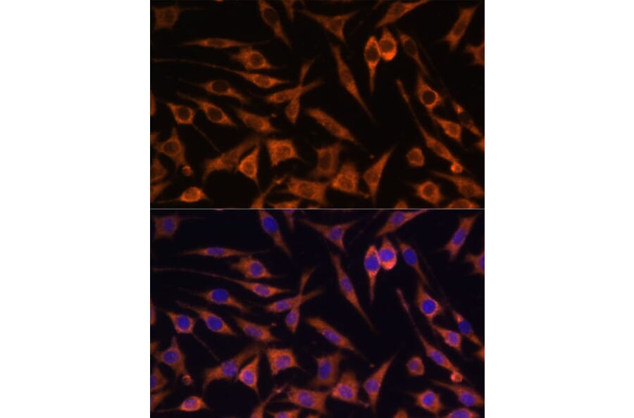 Immunofluorescence - Anti-ACAT2/Acetyl-CoA acetyltransferase Antibody (A12183) - Antibodies.com
