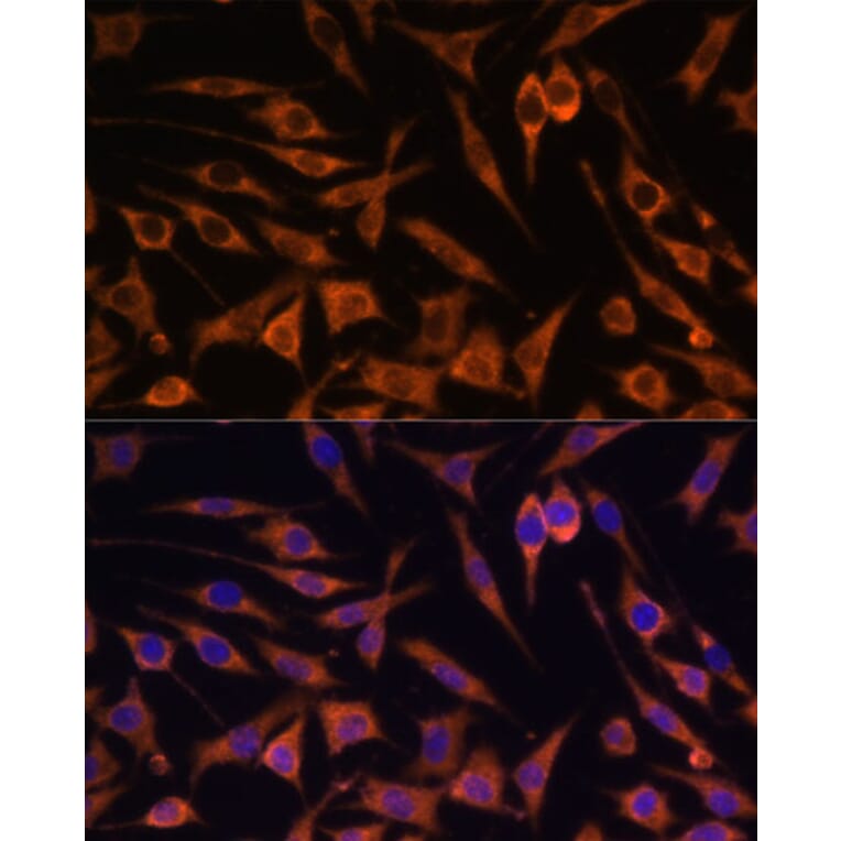 Immunofluorescence - Anti-ACAT2/Acetyl-CoA acetyltransferase Antibody (A12183) - Antibodies.com