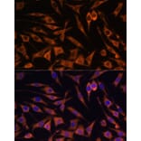 Immunofluorescence - Anti-ACAT2/Acetyl-CoA acetyltransferase Antibody (A12183) - Antibodies.com