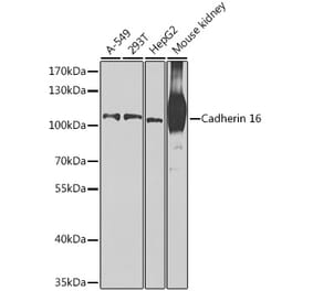 Western Blot - Anti-Cadherin 16 Antibody (A12184) - Antibodies.com