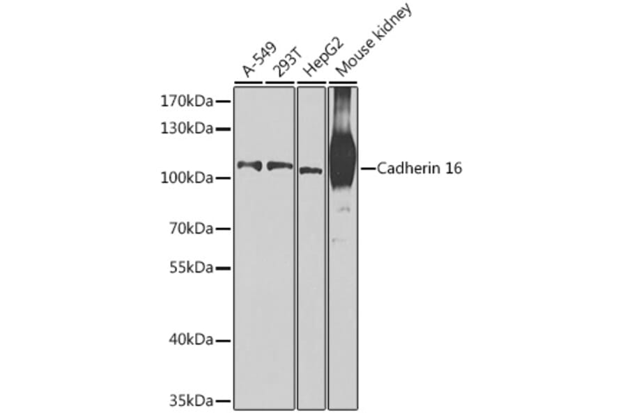 Western Blot - Anti-Cadherin 16 Antibody (A12184) - Antibodies.com