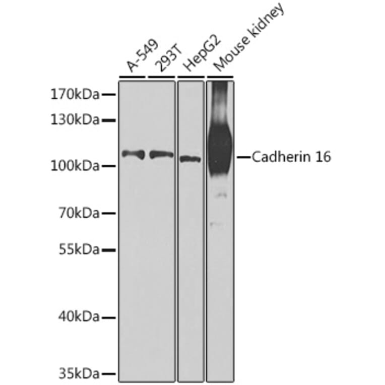 Western Blot - Anti-Cadherin 16 Antibody (A12184) - Antibodies.com