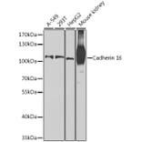 Western Blot - Anti-Cadherin 16 Antibody (A12184) - Antibodies.com