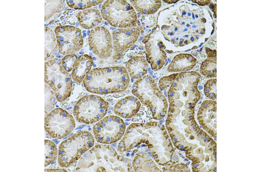 Immunohistochemistry - Anti-Cadherin 16 Antibody (A12184) - Antibodies.com