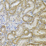 Immunohistochemistry - Anti-Cadherin 16 Antibody (A12184) - Antibodies.com