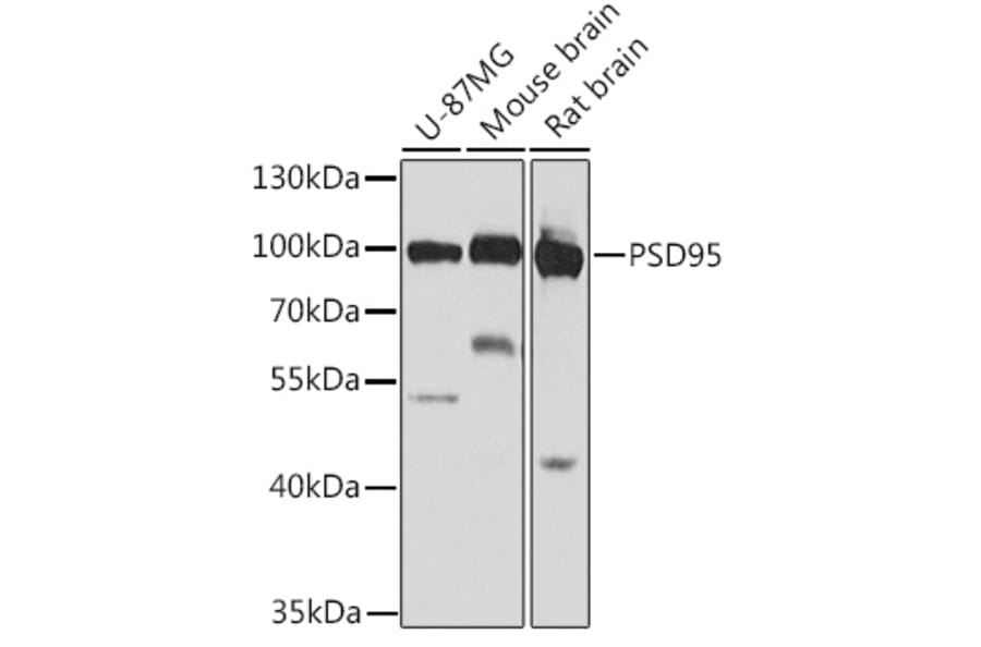 Western Blot - Anti-PSD95 Antibody (A12185) - Antibodies.com