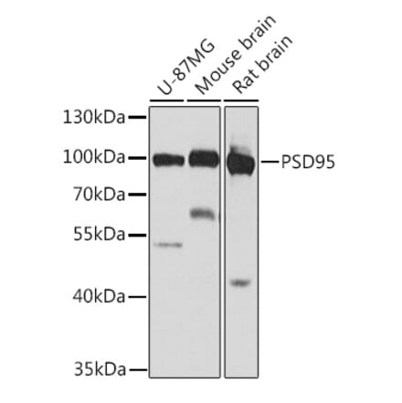 Western Blot - Anti-PSD95 Antibody (A12185) - Antibodies.com